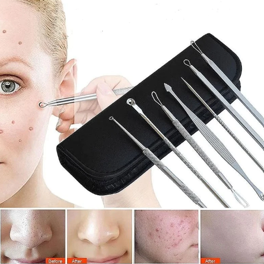 Kit 7 Curetas Remove Cravos Espinhas Aço Inoxidável com Estojo